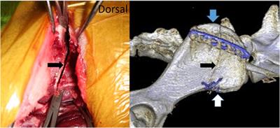 Complete Cranial Iliac Osteotomy to Approach the Lumbosacral Foramen